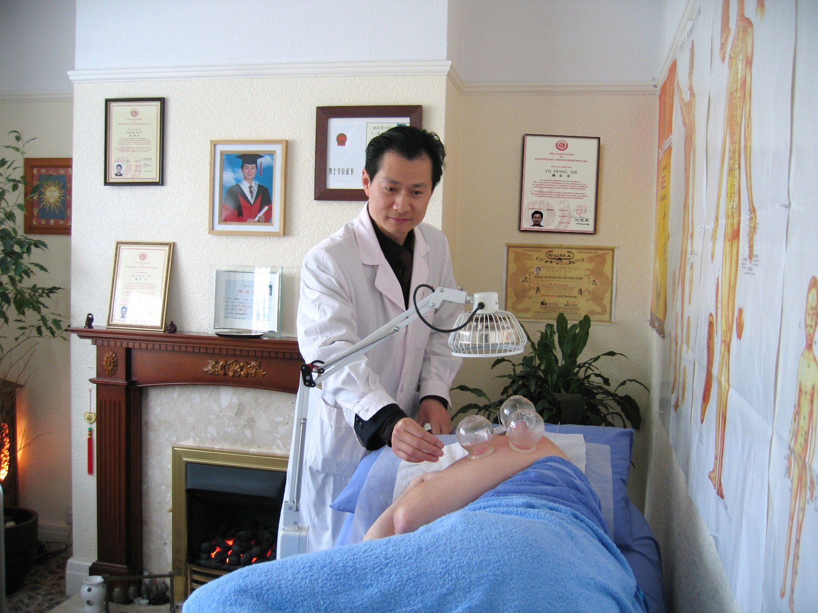 Chinese Acupuncture